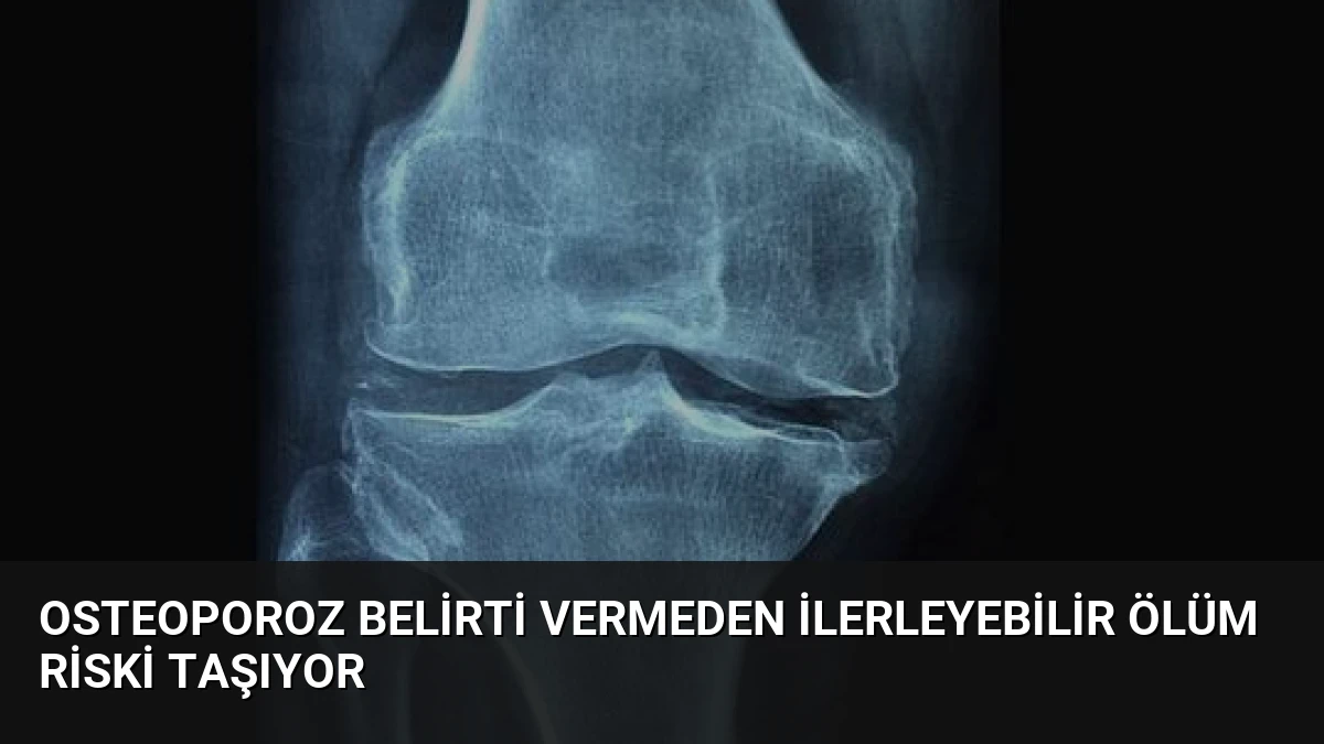 Osteoporoz Belirti Vermeden İlerleyebilir Ölüm Riski Taşıyor