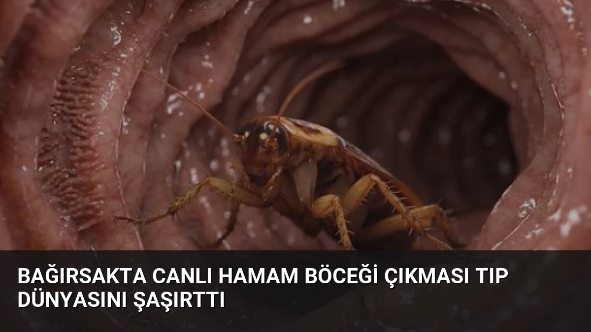 Bağırsakta Canlı Hamam Böceği Çıkması Tıp Dünyasını Şaşırttı